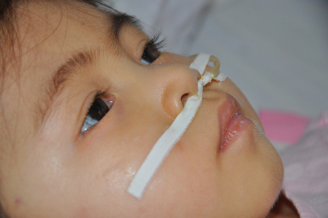 Ám ảnh ánh mắt bé 3 tuổi bị viêm não